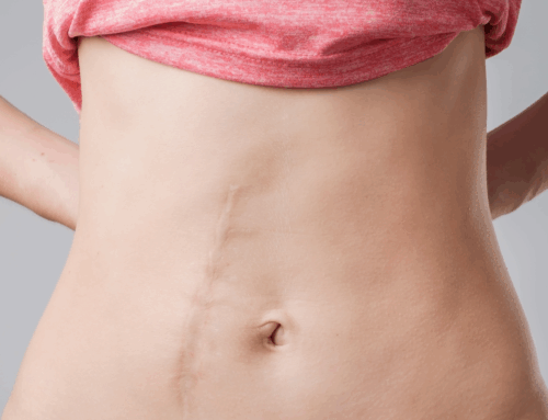 Reikinin Abdominal Cerrahi Hastalarının Anksiyete, Korku, Ağrı ve Yaşam Bulguları üzerine etkisi