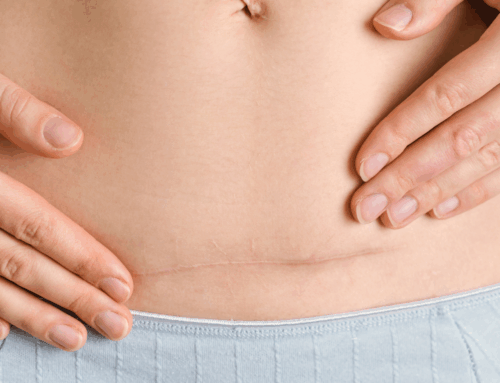 Reiki’nin Sezeryan ameliyatı sonrası ağrı ve anksiyete üzerine etkisi